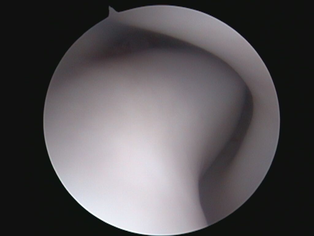 endoscopia diagn1 image photo